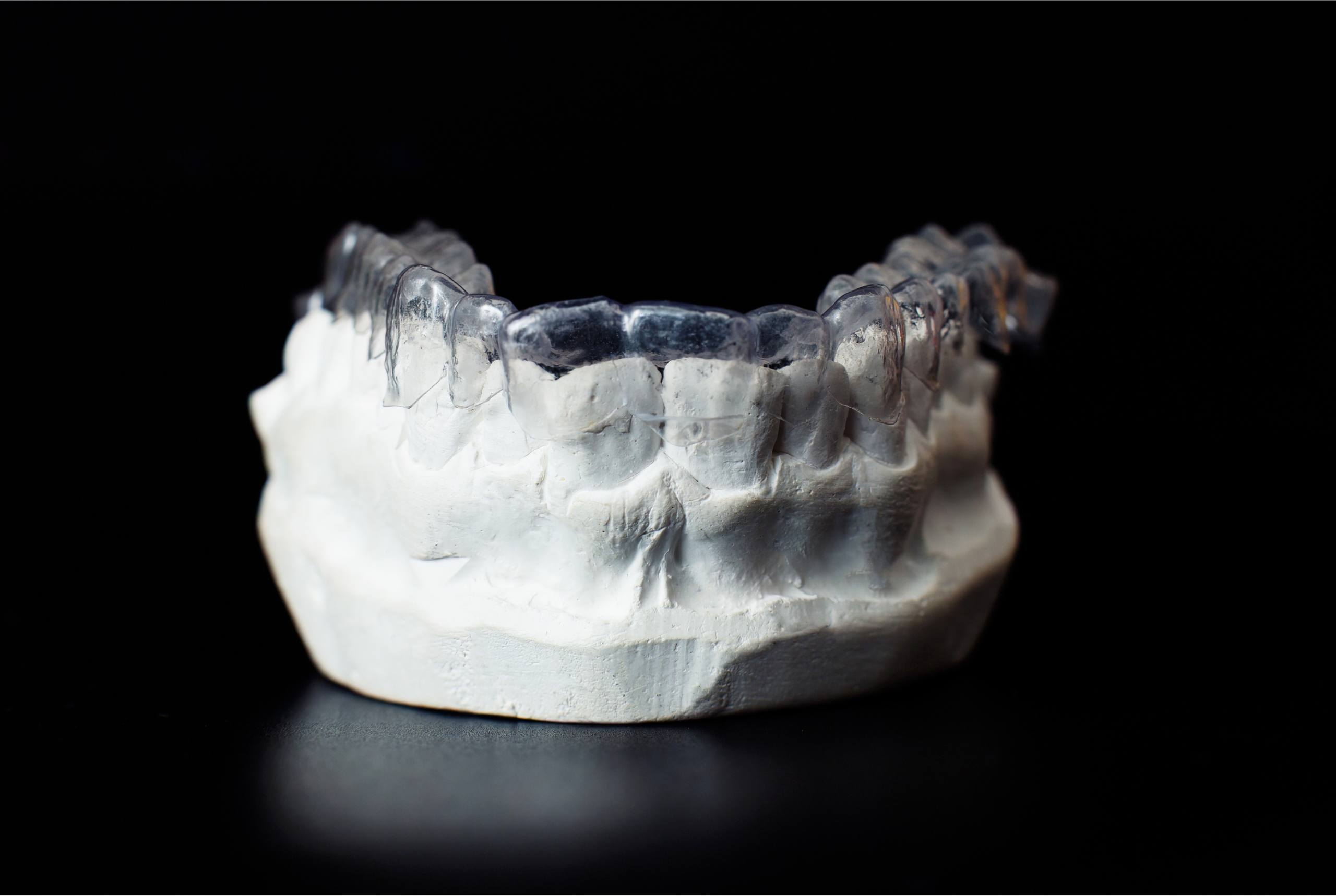 Aufbissschiene auf Gipsmodell