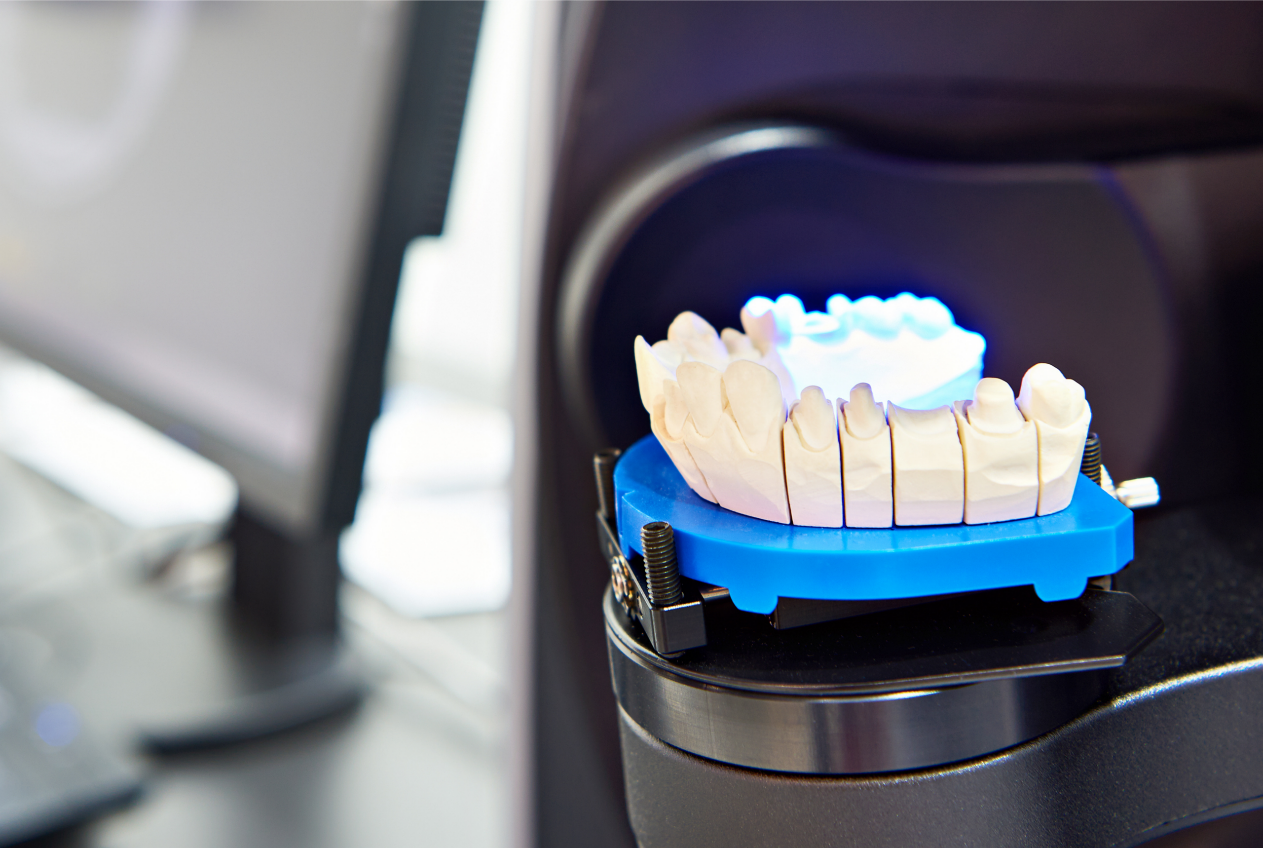 Gipsmodell eines Unterkiefers im Scanner positioniert