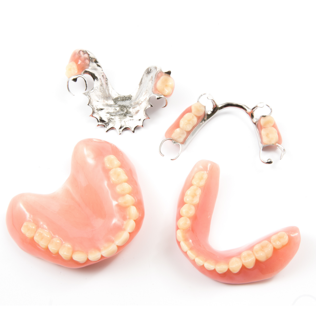 Herausnehmbarer Zahnersatz, oben zwei Modellgussprothesen und unten zwei totale Prothesen