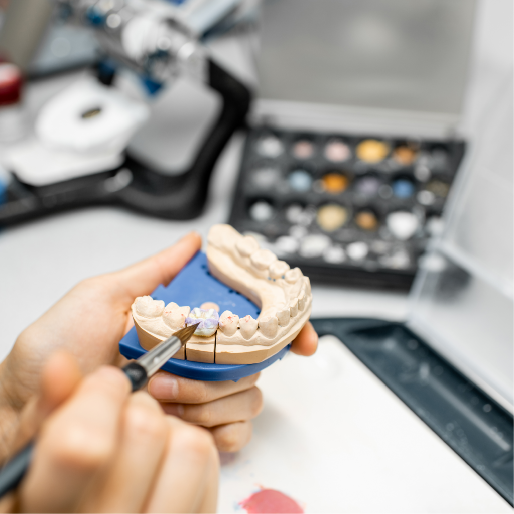 Farbgestaltung eines Zahnimplantats